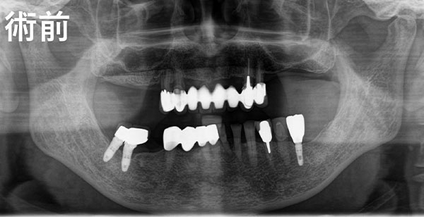 治療前