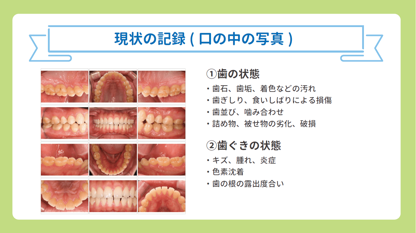 現状の歯の記録