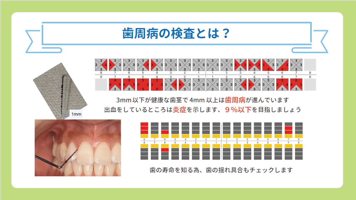 歯周病の検査とは？